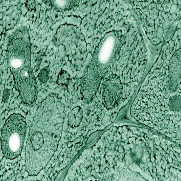 Intracellular ice and cell survival in seeds of Acer