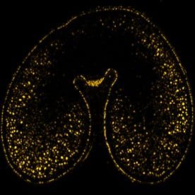 Effects of nitrogen on ω-gliadins in wheat grain