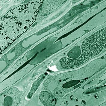 Molecular analysis and evolution of forisomes