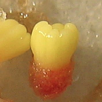 Light effects on somatic and zygotic embryogenesis in larch