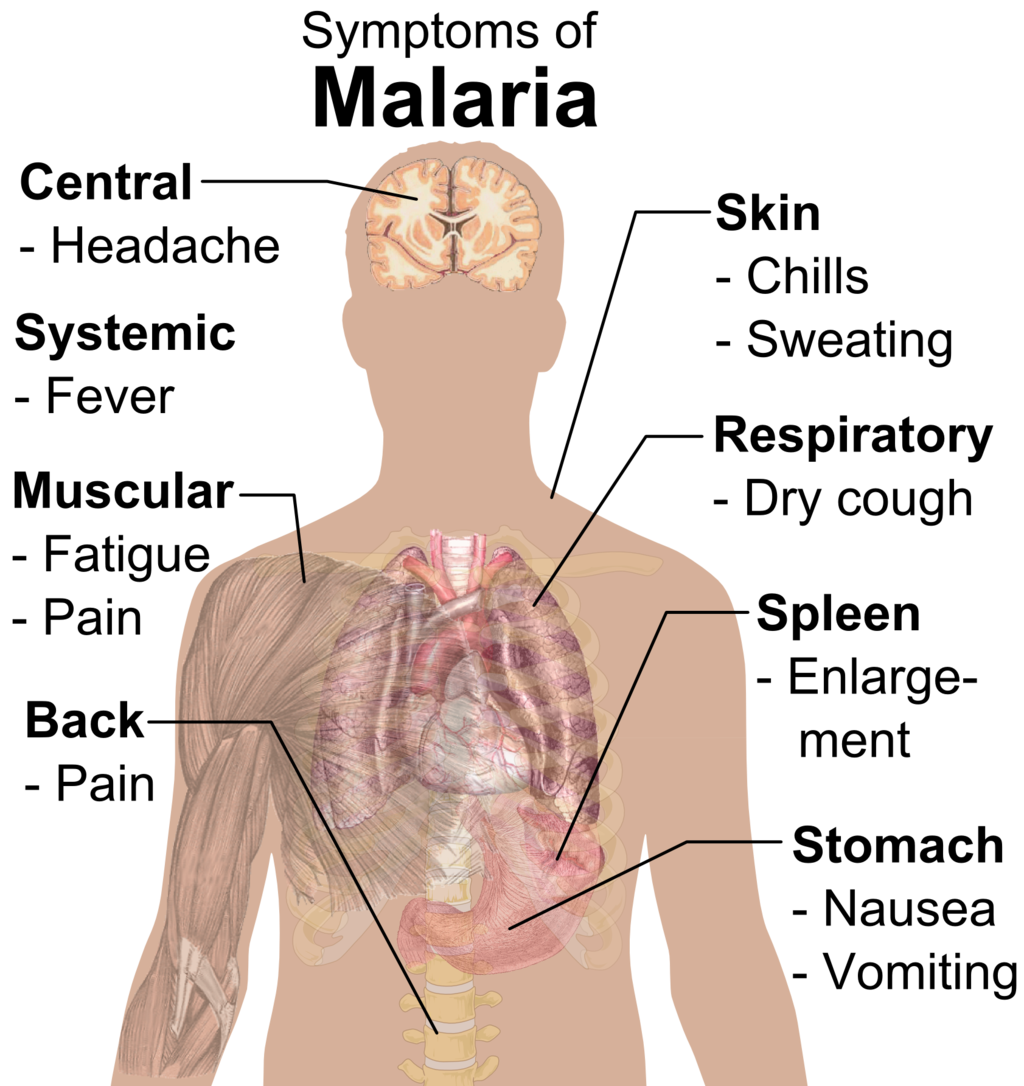 Symptoms of Malaria