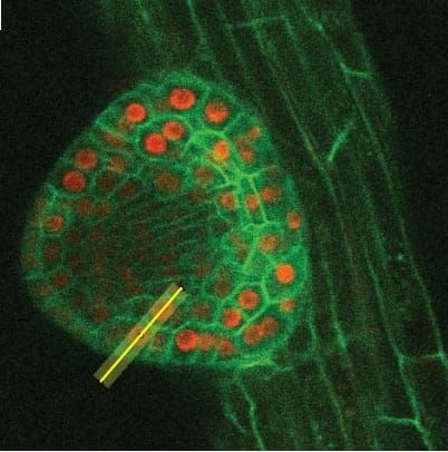 Lateral root primordia expressing GFP-plasma membrane marker UBQ10::YFP-PIP1;4 and RFP-nuclear UBQ10::H2B-RFP marker