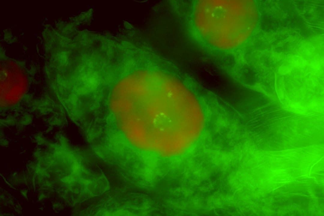 Stained orchid cells.