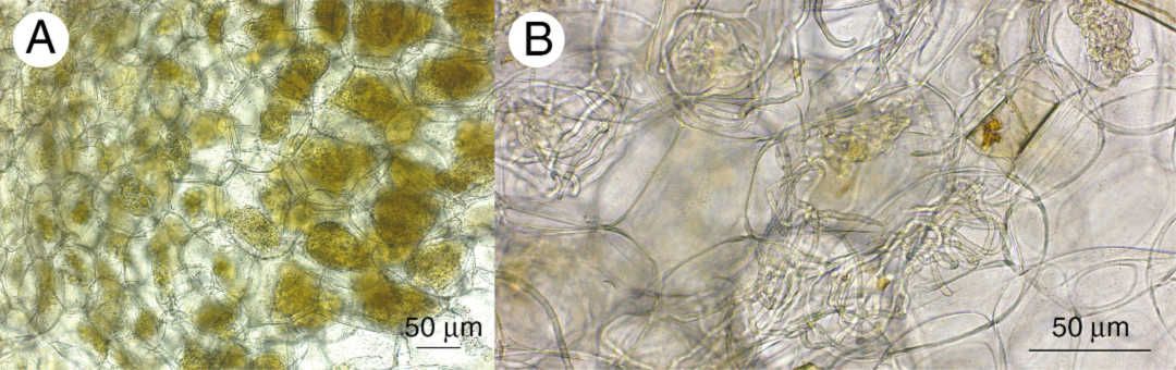 Micrographs of root cross-sections from Anoectochilus sandvicensis