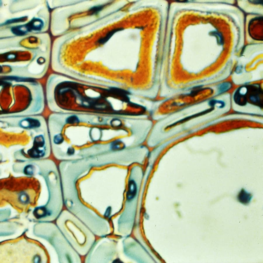 Cells with infections and defences