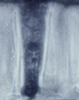 Hourglass cell development