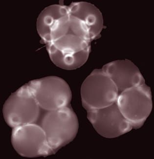 Tetrad shape and aperture pattern ontogeny in pollen