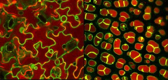 Stained plant cells