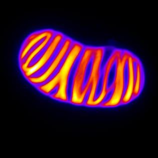 Cell biology of lignification in higher plants (Review)