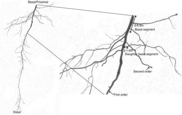 Scheme for describing the terminology of roots and the definition of root traits.