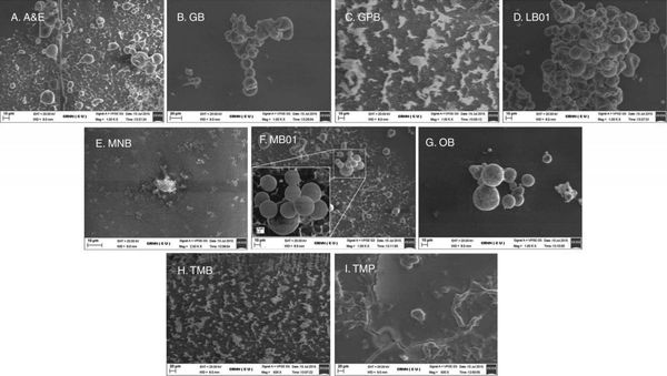 Photomicrographs obtained from bio-SEM analyses of A. zerumbet shoot nuclear suspensions using different isolation buffers.