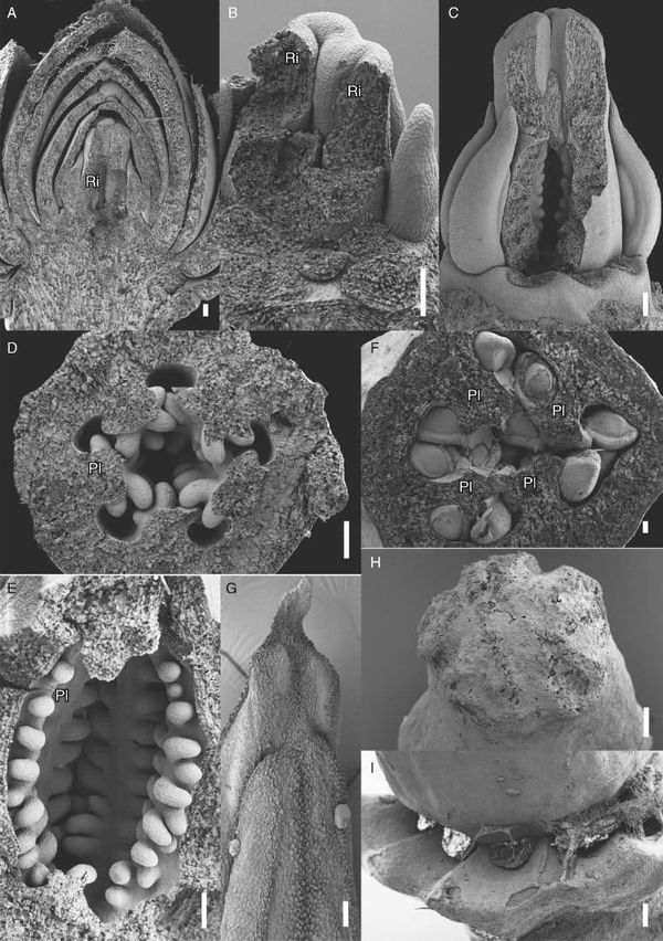 Late floral and gynoecial differentiation of Berberidopsis beckleri.