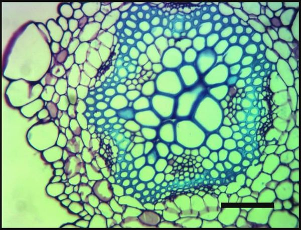 Turgor in cells