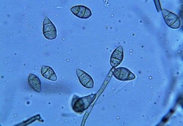Success the hard way: iron-dependent cell death in a rice pathogen