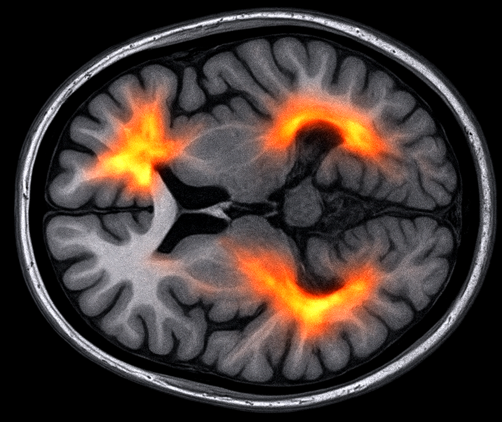 Your Brain on Gratitude