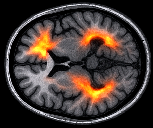 Your Brain on Gratitude