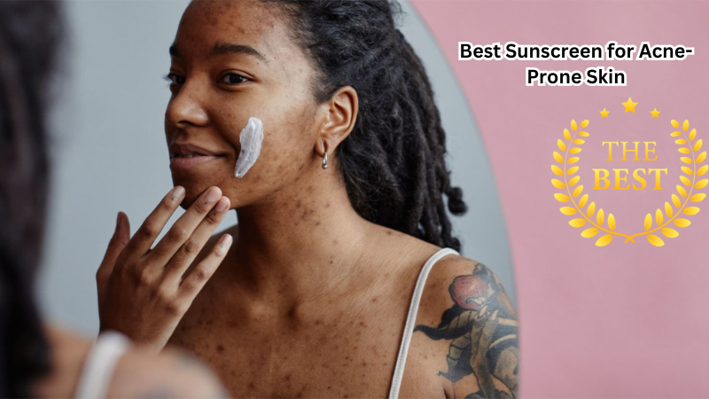 Sun Safety Essentials: Guide to the Best Sunscreen for Acne-Prone Skin