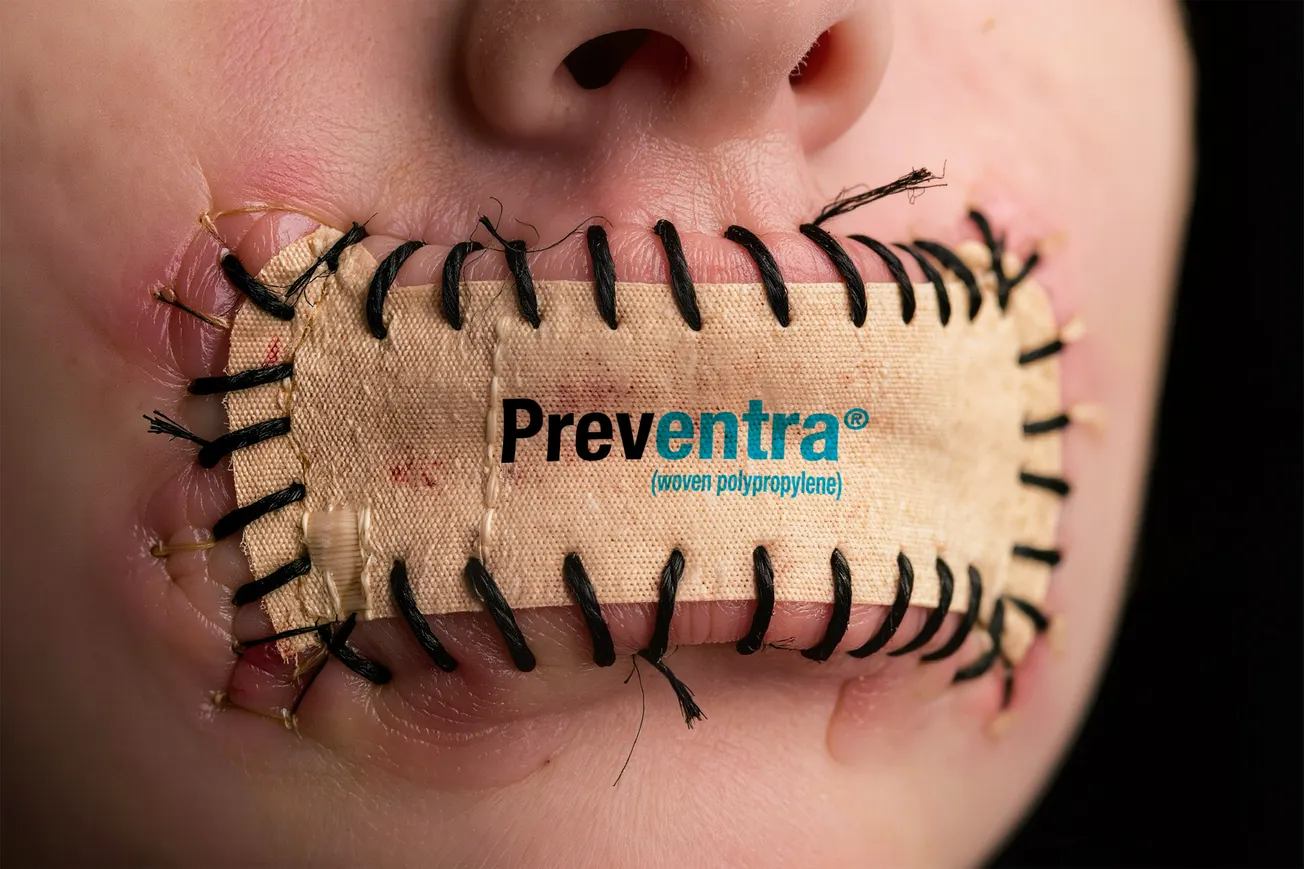 FDA Approves Revolutionary Weight Loss Patch Sewn Directly Over the Mouth
