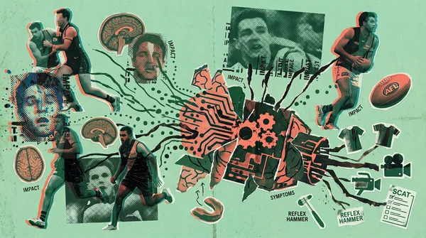 The concussion file 🧠
