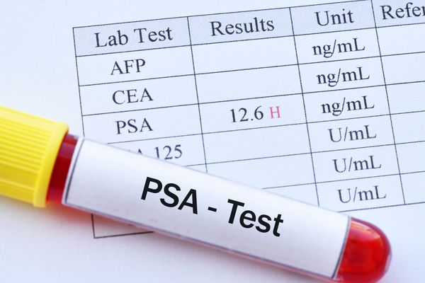 psa指數