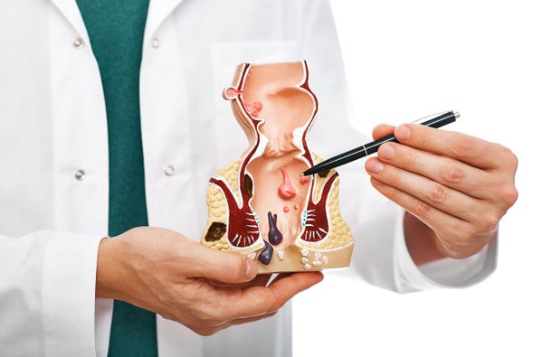 【大腸癌】有何先兆？整合早期症狀、原因、篩檢及治療方法！