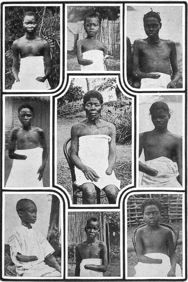 Belgium's Legacy in Congo: The Heart of Darkness