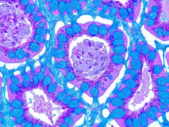 "AI Works" 7.2: Medical Imaging and the Myth of Autonomous Diagnosis