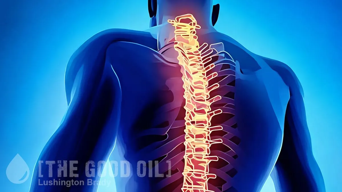 Big Business Shivers Find a Spine to Run Up