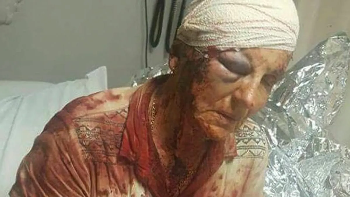 ABC’s Fake News Attack on SA Refugees