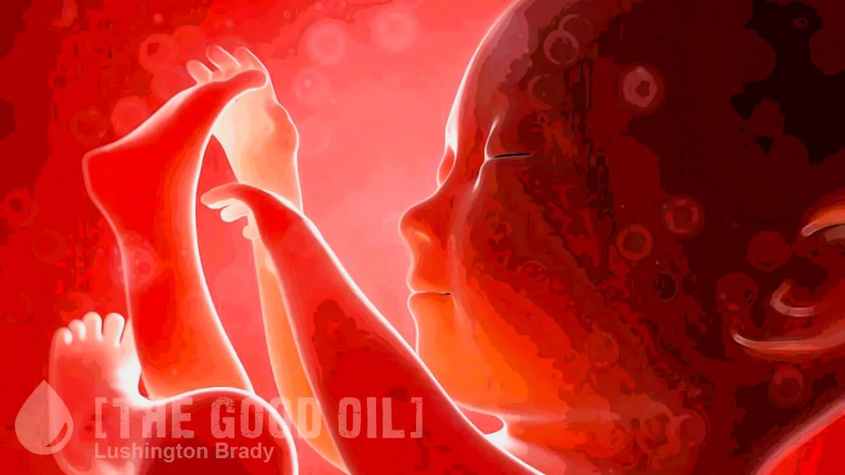 Doublethink Is a Bold Strategy for the ACLU