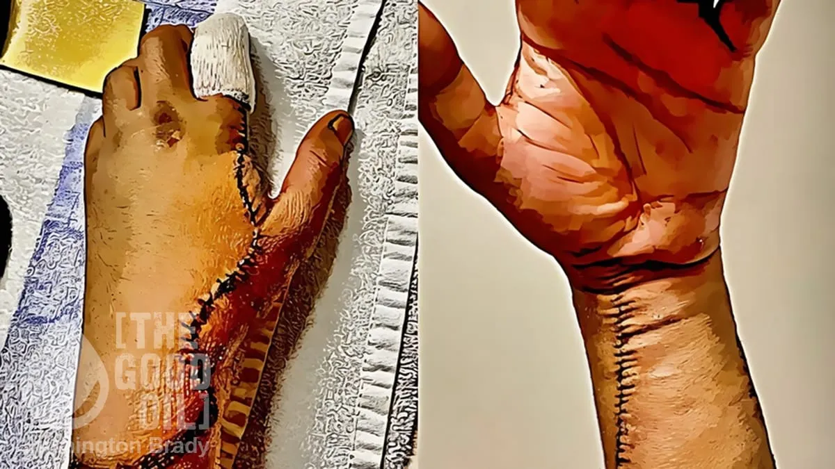 Put Him up at Yours, Then, Your Honour #7