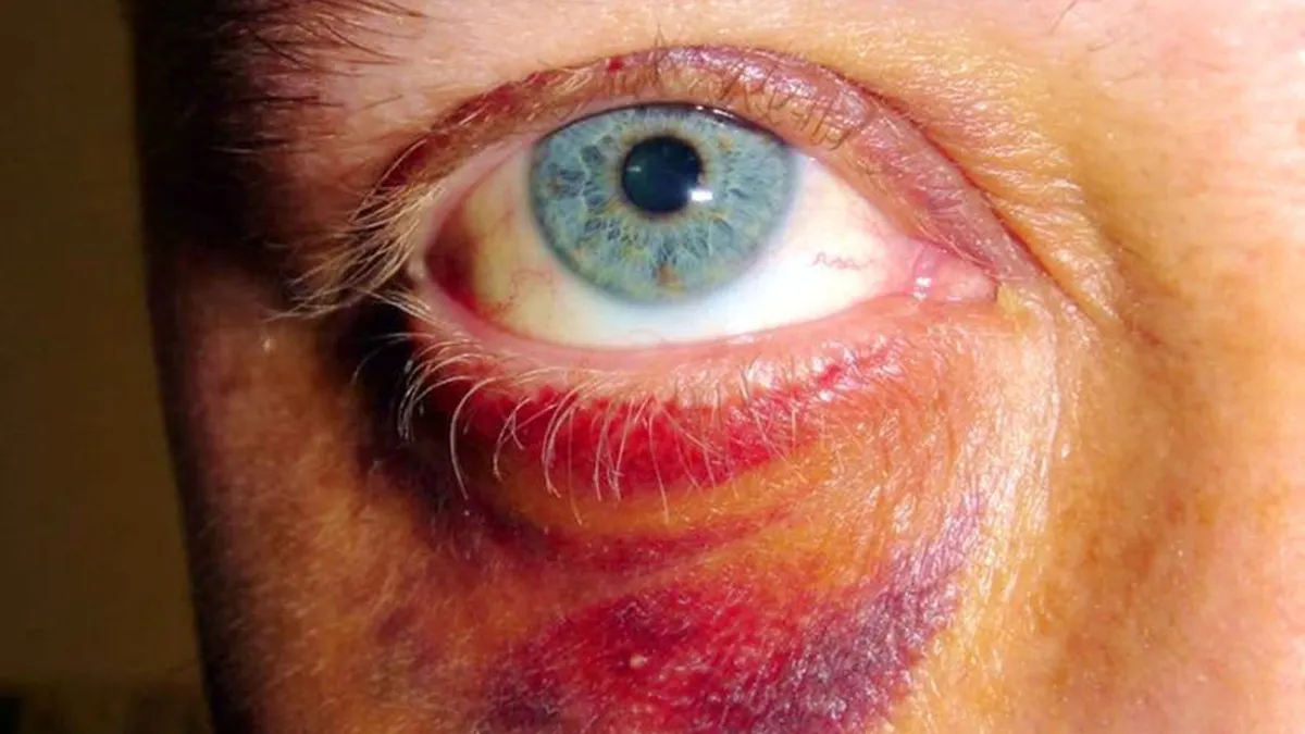 Taxpayer-Funded Feminists Blame and Shame Male Victims of Violence