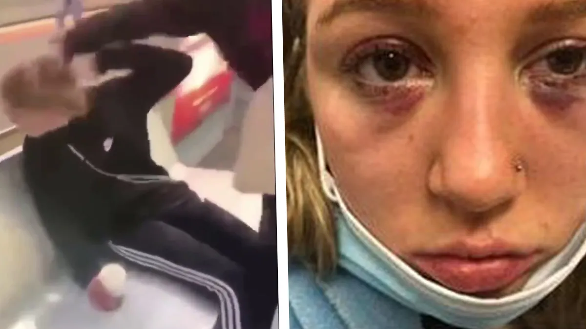 Nothing to See Here – Ignore That Bloodied White Girl