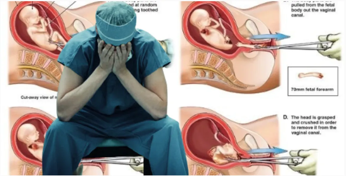 Conscientious Objection to Abortion Is at Risk in Europe