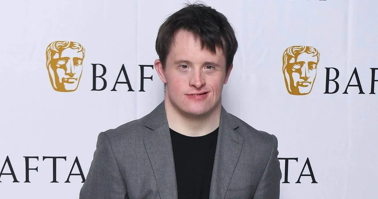 Mother of BBC’s Line of Duty Star with Down’s Syndrome Thankful She Did Not Have Pre-natal Test
