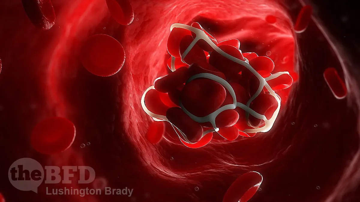 Two Cases of Young Women Gone Forever