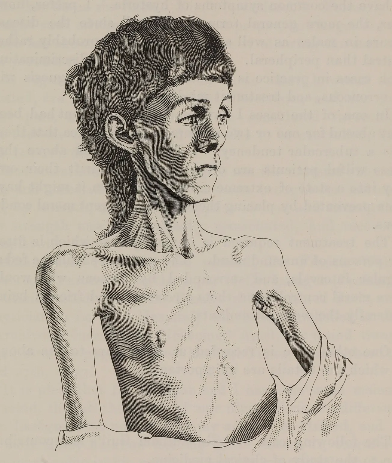 Matt Doocey – Urgent Support Needed for Eating Disorder Services