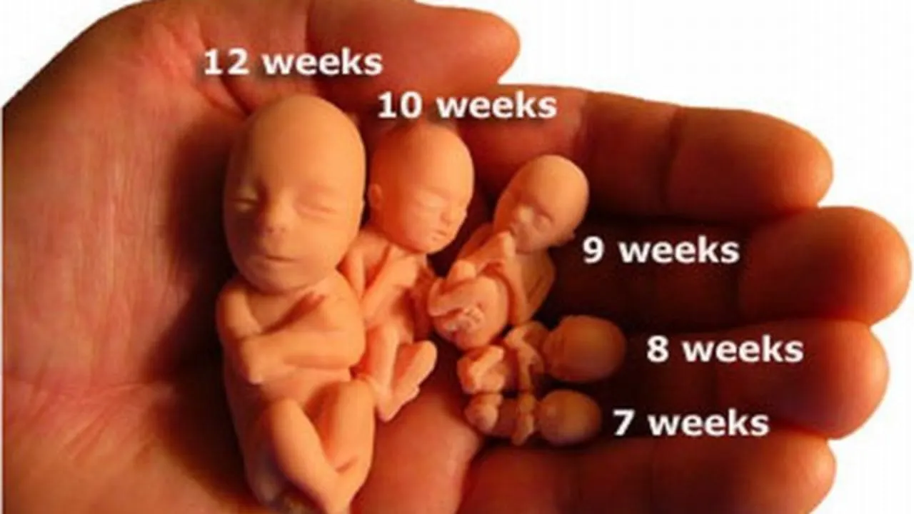 We Must Continue to Speak Up