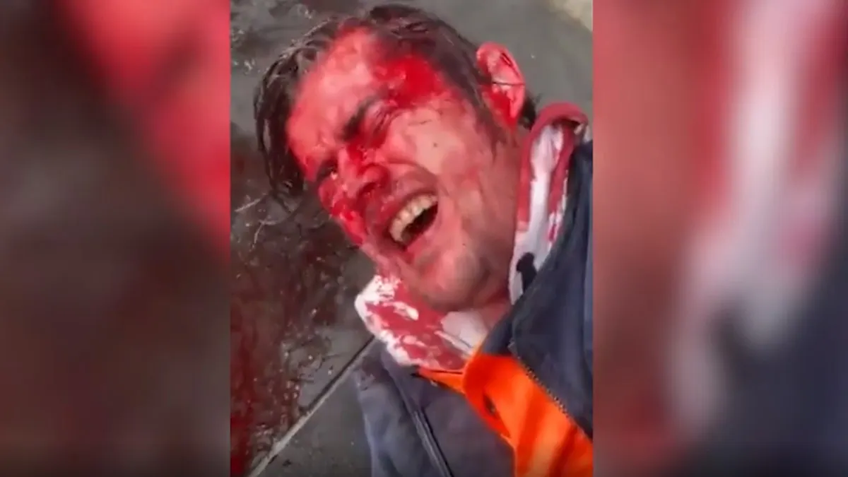 Head-Cracking Copper Suspended