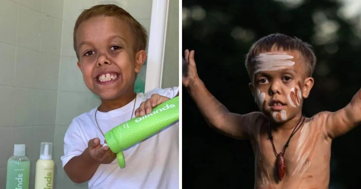 Bullied Boy Now Thriving