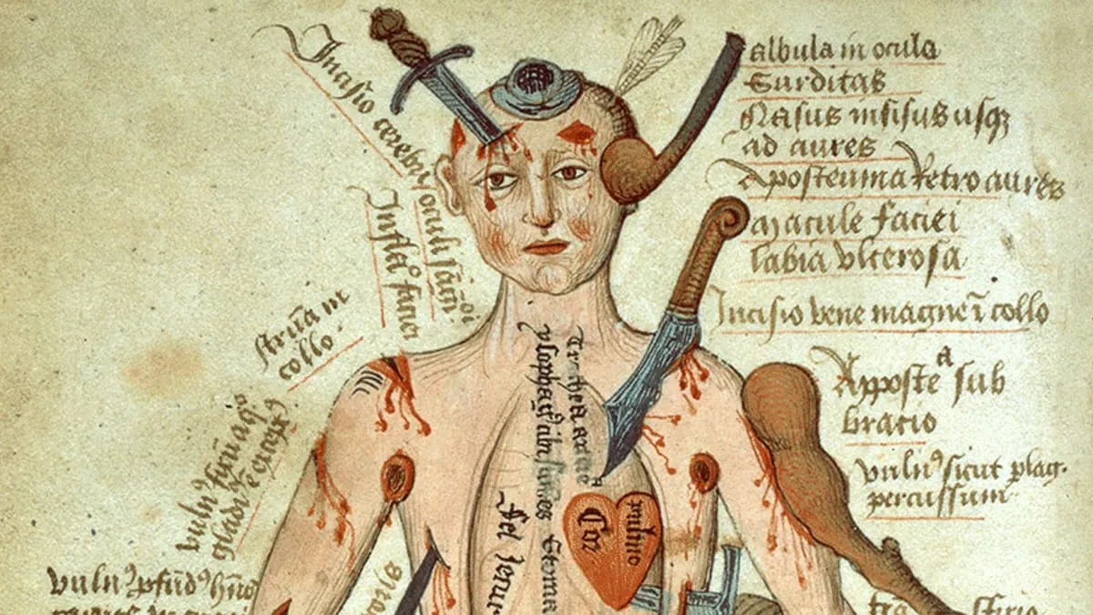 Just Be Glad You Didn’t Get Sick in the Middle Ages