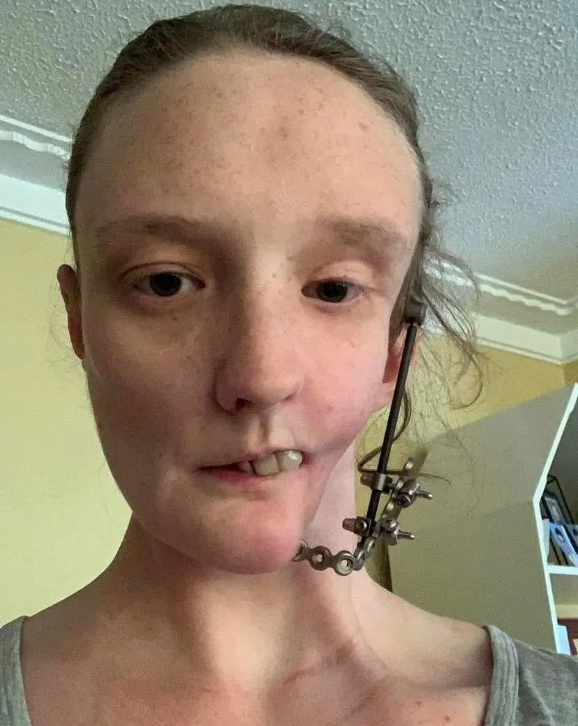 Face of the Day