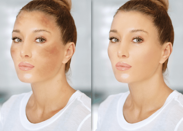 Transform Your Skin with Topicals Faded Serum for Dark Spots Discoloration