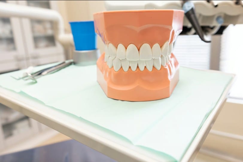 Close-up of a plastic dental teeth model sitting on a medical tray in a dental clinic.
