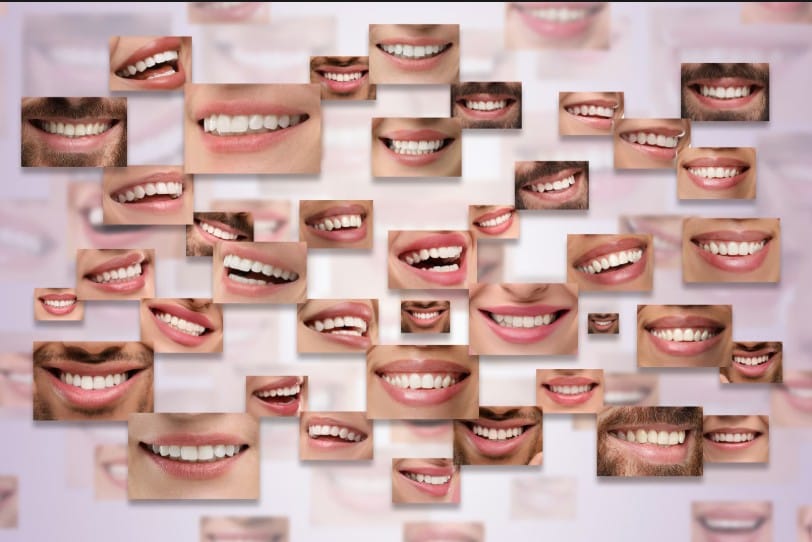 Photo collage of various men and women showcasing white, straight smiles after cosmetic dentistry and teeth whitening.