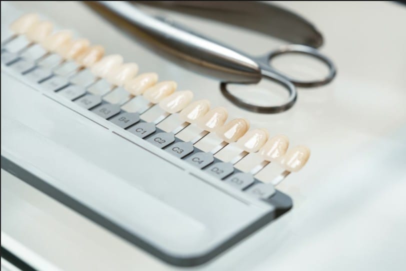 Professional dental tooth shade guide palette with veneer and crown samples for teeth whitening and cosmetic dentistry.