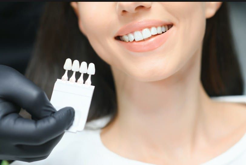 Dentist holding a tooth shade guide next to a patient’s bright smile during a teeth whitening procedure.
