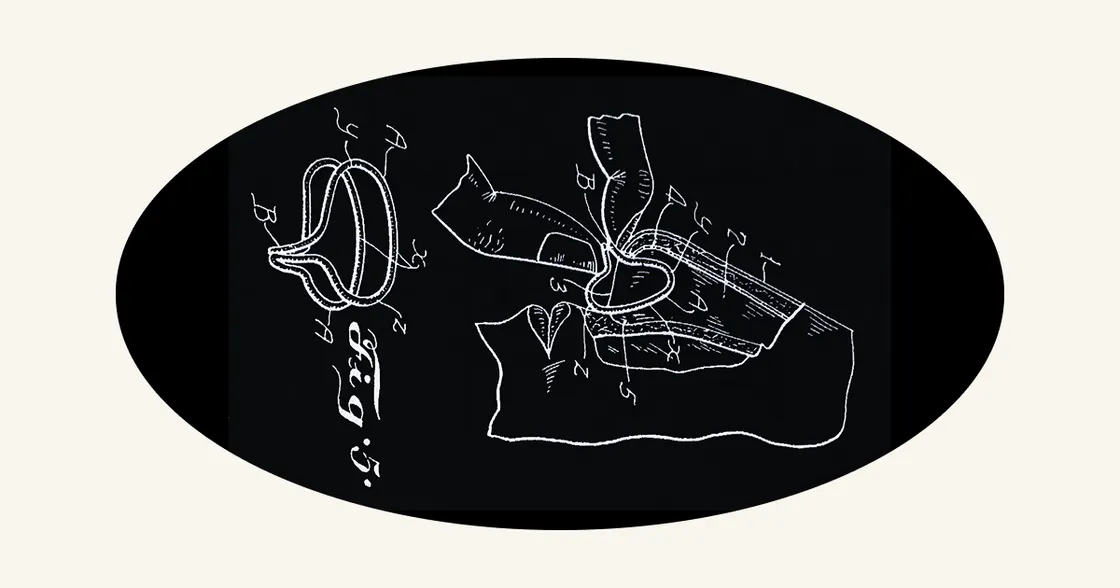 August 24: Thurston's Nostril Expander