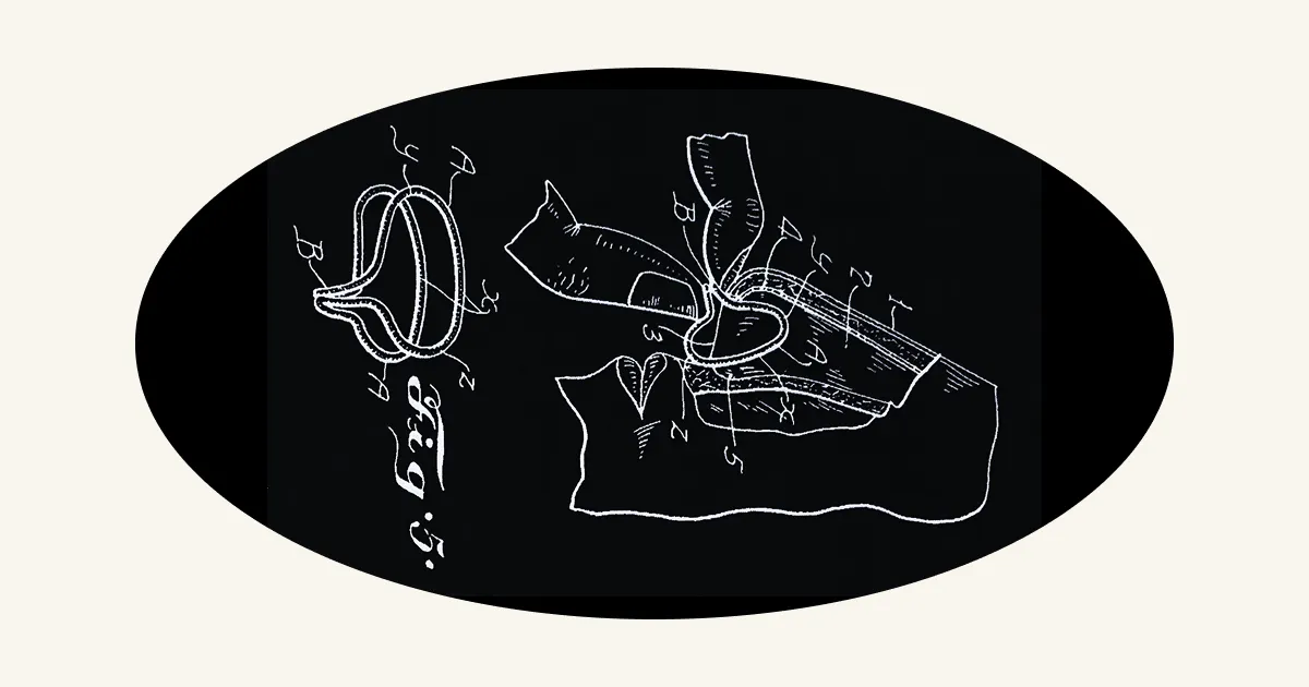 August 24: Thurston's Nostril Expander