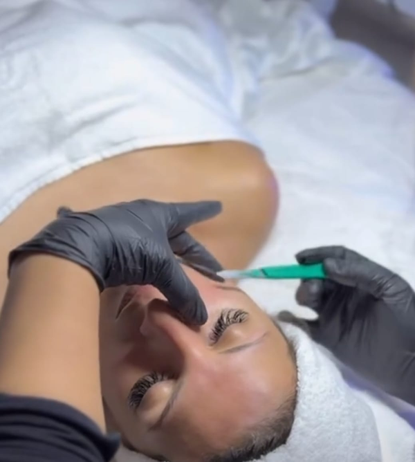 Dermaplaning: The Glow-Boosting Skincare Secret You Didn’t Know You Needed